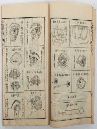 西醫略論. [Xiyi luelun]. [The First Lines of The Practice of Surgery in The West].