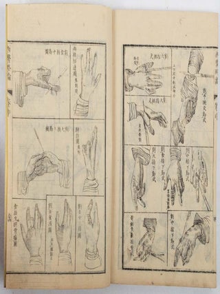 西醫略論. [Xiyi luelun]. [The First Lines of The Practice of Surgery in The West].